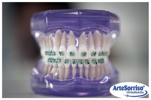 aparelho dentario arte sorriso marcio cercato dentista florianopolis clinica dentaria