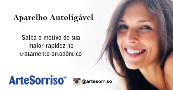 aparelho autoligavel sorriso