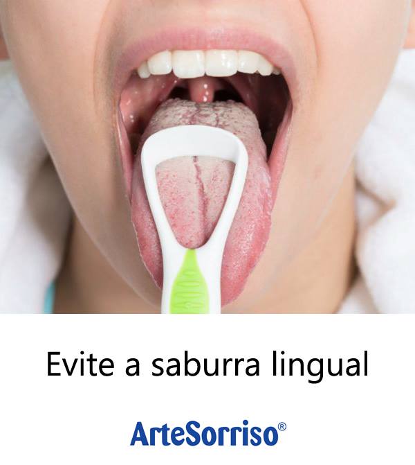 dentista florianopolis ingleses saburra lingua