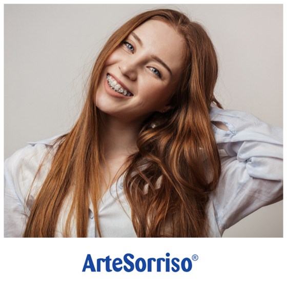 aparelho autoligado dentista ingleses